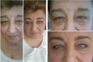 sminktanácsadás age attraction púder